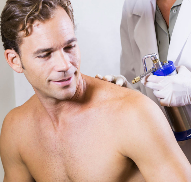 Cryosurgery