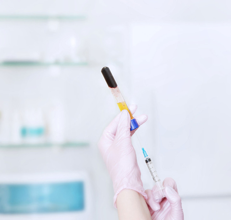 PRP Therapy