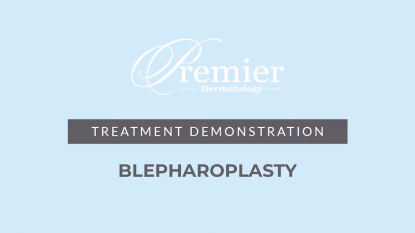 Blepharoplasty Eyelid Rejuvenation