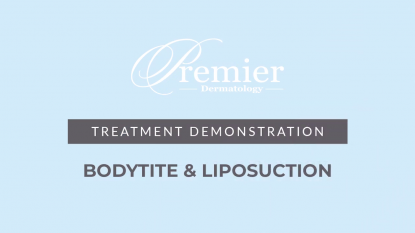 BodyTite + Liposuction