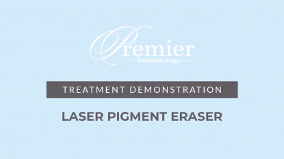 Laser Pigment Eraser